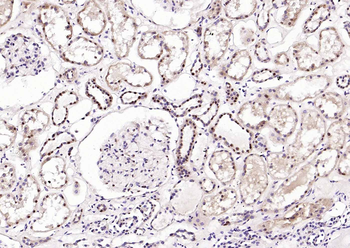 ATF2 Rabbit Polyclonal Antibody