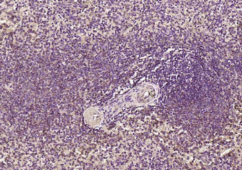 ATF2 Rabbit Polyclonal Antibody