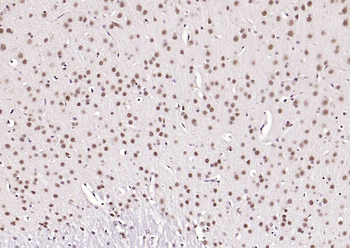 ATF2 Rabbit Polyclonal Antibody