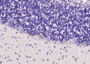 MAGEC2 Rabbit Polyclonal Antibody