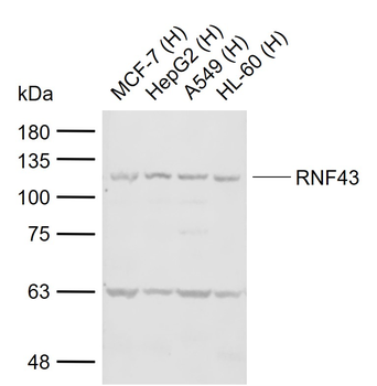 RNF43 Rabbit Polyclonal Antibody
