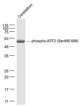 Phospho-ATF2 (Ser490/498) Rabbit Polyclonal Antibody