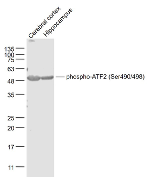 Phospho-ATF2 (Ser490/498) Rabbit Polyclonal Antibody