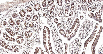 Natriuretic Peptide Receptor A Rabbit Polyclonal Antibody