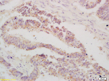 ATF3 Rabbit Polyclonal Antibody