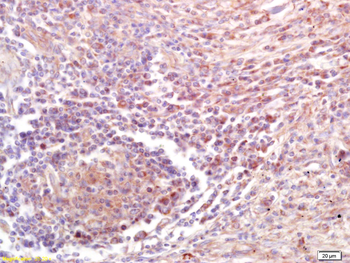 ATF3 Rabbit Polyclonal Antibody