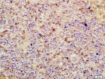 ATF3 Rabbit Polyclonal Antibody
