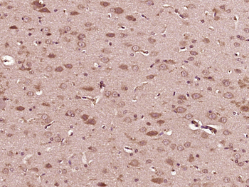 Acid sphingomyelinase Rabbit Polyclonal Antibody