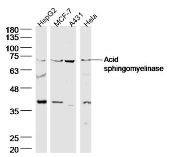 Acid sphingomyelinase Rabbit Polyclonal Antibody