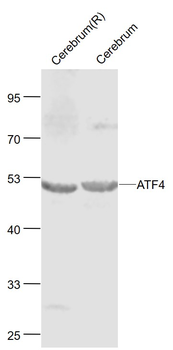 ATF4 Rabbit Polyclonal Antibody