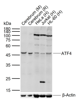 ATF4 Rabbit Polyclonal Antibody