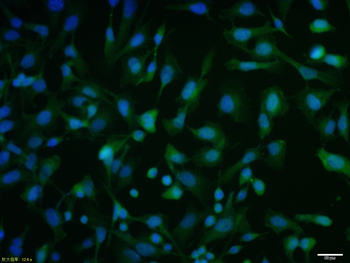 ATF4 Rabbit Polyclonal Antibody