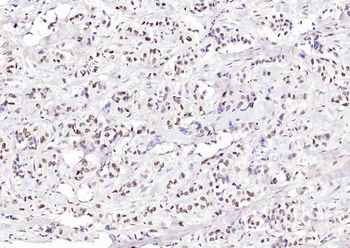 ATF4 Rabbit Polyclonal Antibody