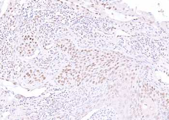 ATF4 Rabbit Polyclonal Antibody