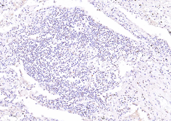 ATF4 Rabbit Polyclonal Antibody