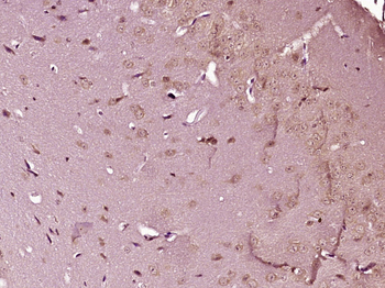 FSCN1 Rabbit Polyclonal Antibody