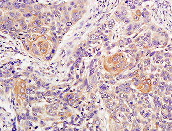 ATM Rabbit Polyclonal Antibody