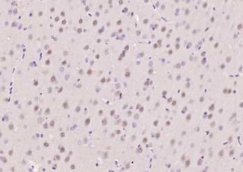ATF6 Rabbit Polyclonal Antibody