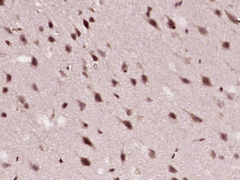 ATF6 Rabbit Polyclonal Antibody