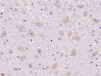 ATF6 Rabbit Polyclonal Antibody