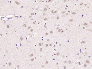 ATF6 Rabbit Polyclonal Antibody