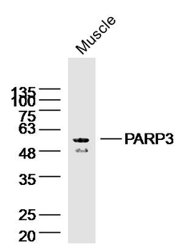 PARP3 Rabbit Polyclonal Antibody