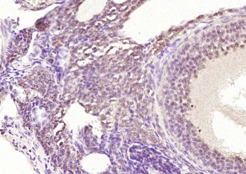 MDM2BP Rabbit Polyclonal Antibody