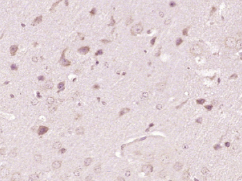 ATP7A Rabbit Polyclonal Antibody