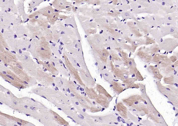ATP7A Rabbit Polyclonal Antibody