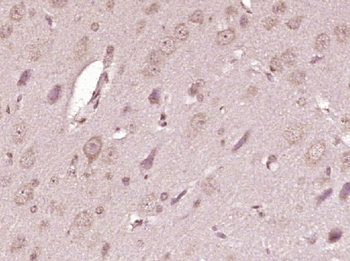 ATP7A Rabbit Polyclonal Antibody