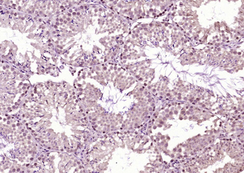 Anillin Rabbit Polyclonal Antibody