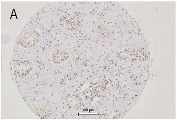 EMT Research Antibody Assembly kit (E-Cadherin,N-Cadherin,Vimentin,Occludin,ZO-1)