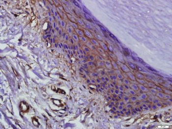 EMT Research Antibody Assembly kit (E-Cadherin,N-Cadherin,Vimentin,Occludin,ZO-1)