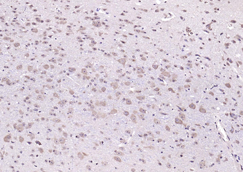 PIK3R1 Rabbit Polyclonal Antibody