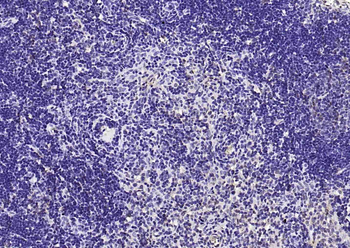 PIK3R1 Rabbit Polyclonal Antibody