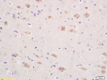 STAM Rabbit Polyclonal Antibody