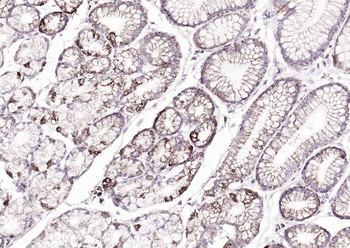 ATP7B Rabbit Polyclonal Antibody