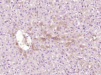 ATP7B Rabbit Polyclonal Antibody