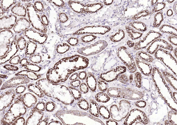 ATP7B Rabbit Polyclonal Antibody