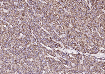 ATP7B Rabbit Polyclonal Antibody