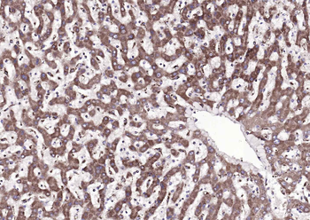 ATP7B Rabbit Polyclonal Antibody