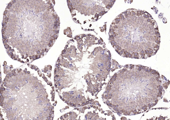 ATP7B Rabbit Polyclonal Antibody