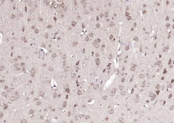 ATP7B Rabbit Polyclonal Antibody