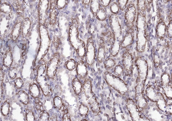 ATP7B Rabbit Polyclonal Antibody