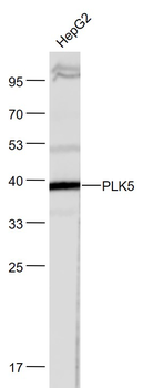 PLK5 Rabbit Polyclonal Antibody