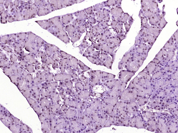 TBRG1 Rabbit Polyclonal Antibody