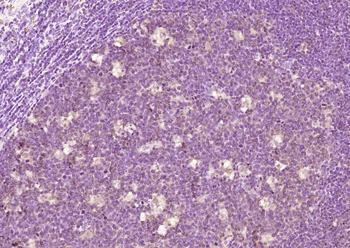 HURP Rabbit Polyclonal Antibody