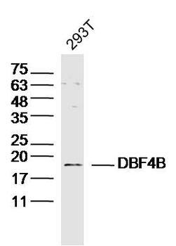 DBF4B Rabbit Polyclonal Antibody