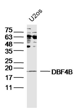DBF4B Rabbit Polyclonal Antibody