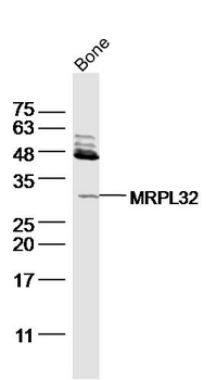 FGF23 Rabbit Polyclonal Antibody